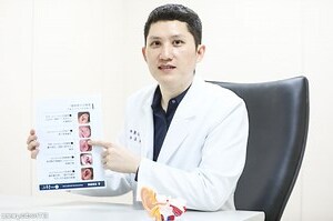 尖耳朵 面相